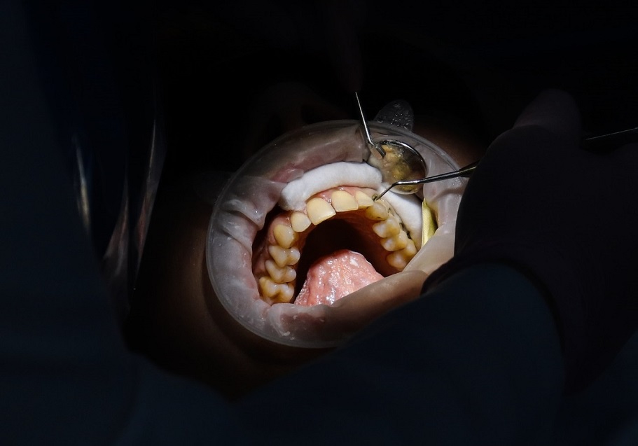 Курсы гигиениста стоматологического обучение профилактической стоматологии