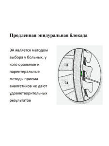 Обучение интервенционное лечение боли