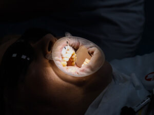 Стоматолог терапевт обучение