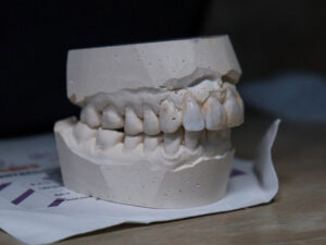 Курсы по ортопедической стоматологии в Москве