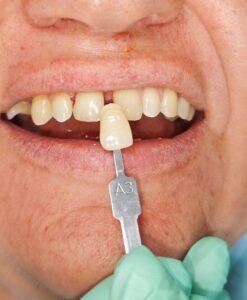 курсы для зубных техников