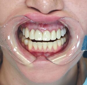 обучение на зубных техников