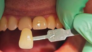 аккредитация стоматолог ортопед