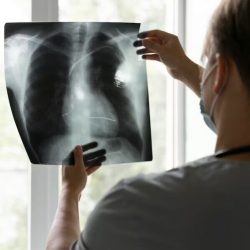 Пульмонология обучение от 36 до 720 часов. Проводим специализацию и усовершенствование врачей-пульмонологов в лицензированном Центре ДПО
